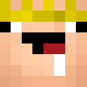 Skin Head