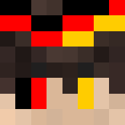 Skin Head