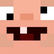 TimmyToilet's head