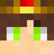 Skin Head