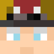 Skin Head