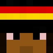 Skin Head