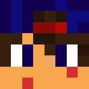 Skin Head