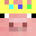 MyFist