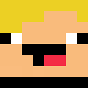 Skin Head
