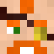 Skin Head