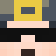 Skin Head