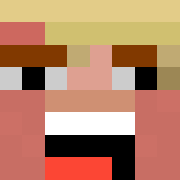 Skin Head