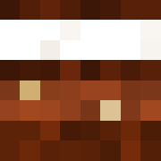 knoperys_