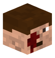 Radxyt